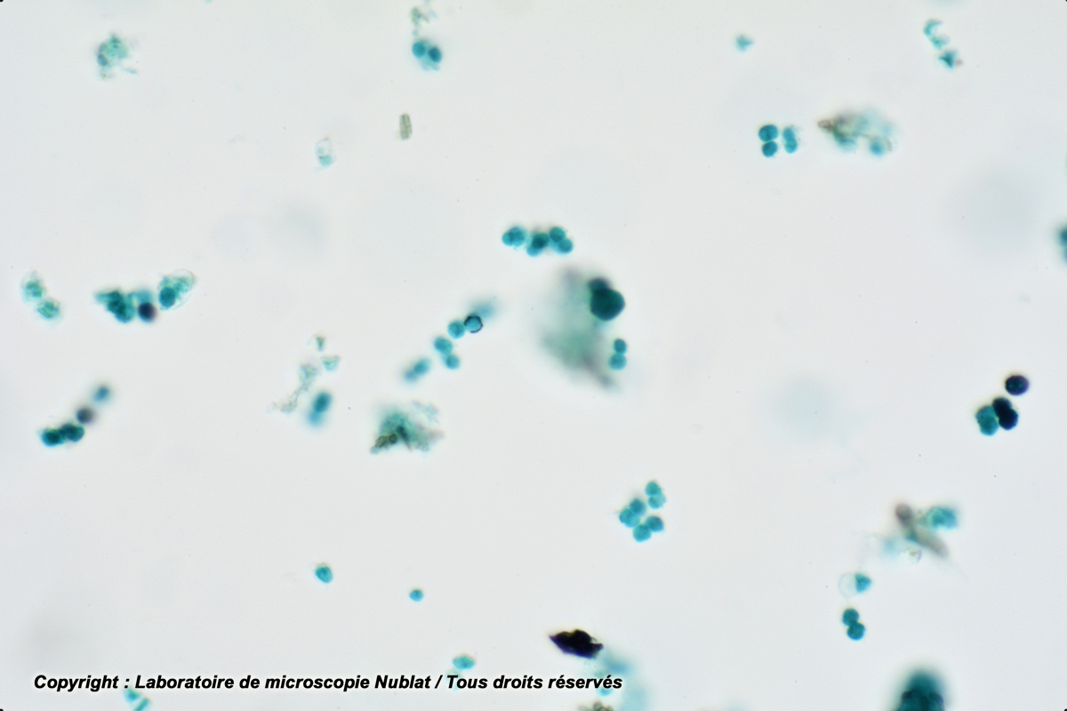 Pleurococcus : algue verte unicell. (tronc d’arbre), VL